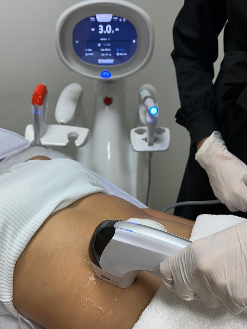 Ultraformer MPT aplicado no abdômen — Estética Hollywood