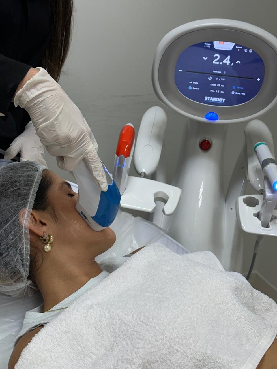 Ultraformer MPT aplicado no queixo — Estética Hollywood